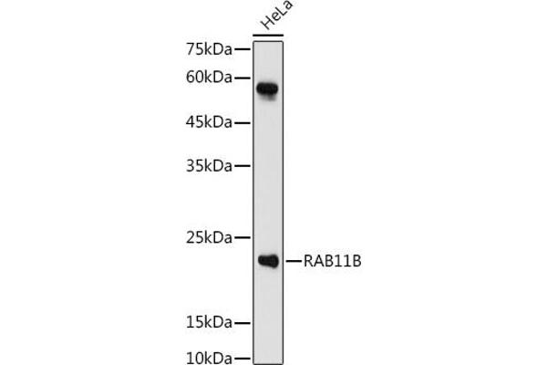 RAB11B 抗体  (AA 130-215)