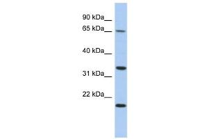 FAM79B antibody used at 1 ug/ml to detect target protein. (TPRG1 antibody  (N-Term))