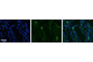 Rabbit Anti-SLCO2B1 Antibody     Formalin Fixed Paraffin Embedded Tissue: Human Lung Tissue  Observed Staining: Membrane in alveolar type I cells  Primary Antibody Concentration: 1:100  Other Working Concentrations: 1/600  Secondary Antibody: Donkey anti-Rabbit-Cy3  Secondary Antibody Concentration: 1:200  Magnification: 20X  Exposure Time: 0. (SLCO2B1 antibody  (N-Term))