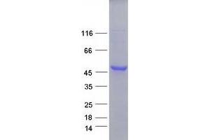 Western Blotting (WB) image for Ribosomal Protein SA (RPSA) (Transcript Variant 2) protein (Myc-DYKDDDDK Tag) (ABIN2730920)