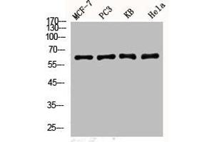 Western Blot analysis of MCF7 PC-3 KB HELA cells using Phospho-YAP (S127) Polyclonal Antibody