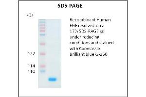 SDS-PAGE (SDS) image for Epidermal Growth Factor (EGF) (Active) protein (ABIN5509294) (EGF Protein)
