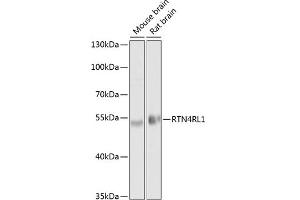 Western blot analysis of extracts of various cell lines, using RTN4RL1 antibody (ABIN6130678, ABIN6147298, ABIN6147299 and ABIN6214124) at 1:1000 dilution. (RTN4RL1 antibody  (AA 220-420))