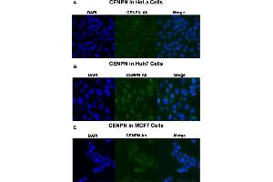 Immunofluorescent staining of HeLa (A), Huh7 (B) and MCF7 (C) cells with CENPN polyclonal antibody  at 1:250 dilution. (CENPN antibody  (Internal Region))