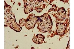 Immunohistochemistry of paraffin-embedded human placenta tissue using ABIN7173594 at dilution of 1:100 (PRSS1 antibody  (AA 104-206))