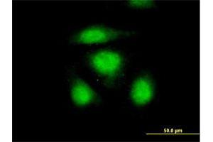 Immunofluorescence of purified MaxPab antibody to OSTF1 on HeLa cell. (OSTF1 antibody  (AA 1-217))