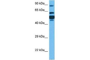 Host:  Rabbit  Target Name:  CPT1A  Sample Tissue:  Human HT1080 Whole Cell  Antibody Dilution:  1ug/ml (CPT1A antibody  (Middle Region))