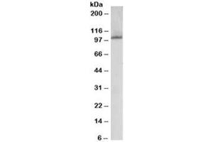Western blot testing of human liver lysate with JIK antibody at 0. (TAO Kinase 3 antibody)