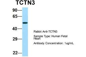 Host:  Rabbit  Target Name:  TCTN3  Sample Type:  Human Fetal Heart  Antibody Dilution:  1. (TCTN3 antibody  (Middle Region))