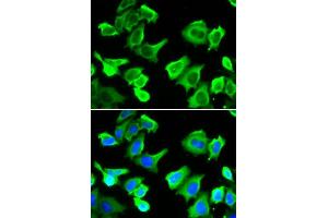 Immunofluorescence analysis of A549 cell using HSPB1 antibody. (HSP27 antibody  (AA 1-120))