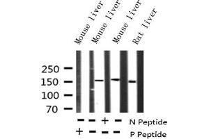 Western blot analysis of Phospho-EGFR (Tyr1172) expression in various lysates