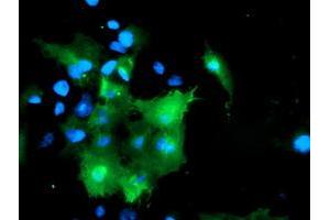 Anti-DOK7 mouse monoclonal antibody (ABIN2455816) immunofluorescent staining of COS7 cells transiently transfected by pCMV6-ENTRY DOK7 (RC219267). (DOK7 antibody)