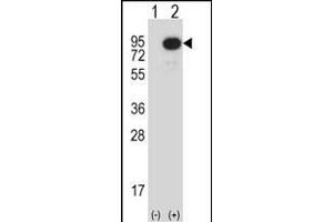 MAP3K2 antibody  (N-Term)