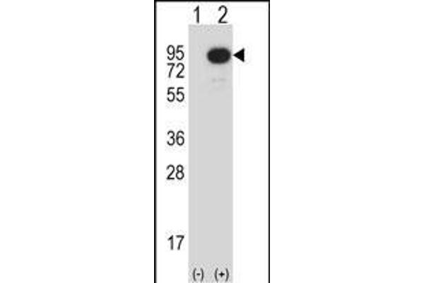 MAP3K2 antibody  (N-Term)