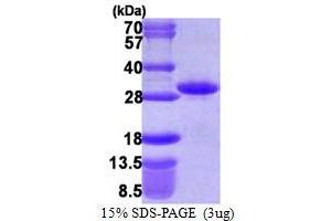 SDS-PAGE (SDS) image for rho Family GTPase 1 (RND1) (AA 1-200) protein (His tag) (ABIN667508) (RND1 Protein (AA 1-200) (His tag))