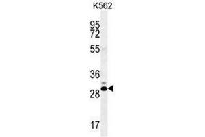 CT45A Antibody (N-term) western blot analysis in K562 cell line lysates (35µg/lane). (CT45A2 antibody  (N-Term))