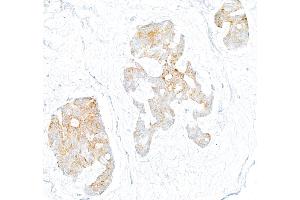 Immunohistochemistry (IHC) image for anti-Oxidized Low Density Lipoprotein (Lectin-Like) Receptor 1 (OLR1) (AA 61-273) antibody (ABIN7795657)