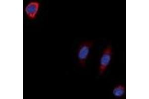 Immunofluorescent analysis of NTR1 staining in SKNSH cells. (NTSR1 antibody)