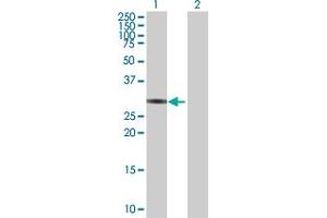 Western Blot analysis of ZNF483 expression in transfected 293T cell line by ZNF483 MaxPab polyclonal antibody. (ZNF483 antibody  (AA 1-244))