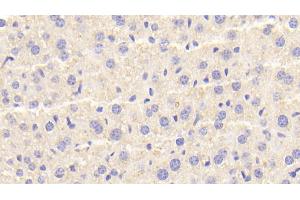 Immunohistochemistry (IHC) image for anti-Cathepsin D (CTSD) (AA 66-410) antibody (ABIN7433375)