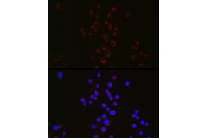 Immunofluorescence (IF) image for anti-Parkinson Protein 2, E3 Ubiquitin Protein Ligase (Parkin) (PARK2) (AA 1-300) antibody (ABIN3021179)