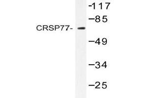 Western blot (WB) analysis of CRSP77 antibody in extracts from HT-29 cells.