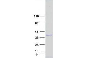 Validation with Western Blot