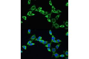 Immunofluorescence analysis of NIH/3T3 cells using VEGFA Rabbit pAb (ABIN6128907, ABIN6150083, ABIN6150084 and ABIN6215912) at dilution of 100 (40x lens). (VEGFA antibody  (AA 27-126))