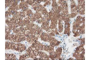 Immunohistochemical staining of paraffin-embedded Human liver tissue using anti-CYP2A6 mouse monoclonal antibody. (CYP2A6 antibody)