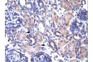 Image no. 1 for anti-TNF Receptor-Associated Protein 1 (TRAP1) (AA 41-90) antibody (ABIN202875) (TRAP1 antibody  (AA 41-90))