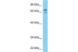 Host:  Rabbit  Target Name:  KCND3  Sample Type:  Stomach Tumor lysates  Antibody Dilution:  1. (KCND3 antibody  (C-Term))