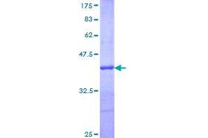 Image no. 1 for Peroxiredoxin 5 (PRDX5) (AA 105-214) protein (GST tag) (ABIN1316161) (Peroxiredoxin 5 Protein (PRDX5) (AA 105-214) (GST tag))