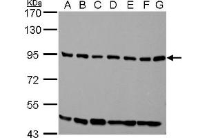 WB Image ELMO1 antibody [C3], C-term detects ELMO1 protein by western blot analysis.