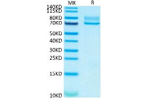 Human Syndecan-1 on Tris-Bis PAGE under reduced condition. (Syndecan 1 Protein (SDC1) (AA 23-254) (Fc Tag))