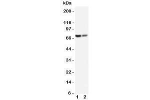 Western blot testing of PMP70 antibody and Lane 1:  rat lung;  2: rat ovary tissue lysate. (PMP70 antibody  (C-Term))