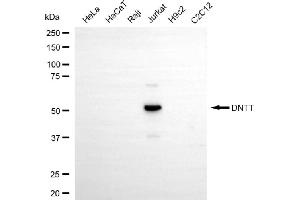 Western blotting analysis using DNTT antibody (ABIN7798310).