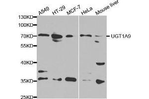 Western blot analysis of extracts of various cell lines, using UGT1A9 antibody. (UGT1A9 antibody  (AA 26-250))