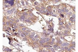 ABIN6267008 at 1/100 staining human Breast tissue sections by IHC-P. (KRT15 antibody)