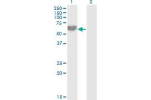 Western Blot analysis of NLK expression in transfected 293T cell line by NLK monoclonal antibody (M02), clone 2B11. (Nemo-Like Kinase antibody  (AA 416-515))