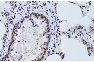 Immunohistochemistry of paraffin-embedded Rat lung using SIRT7 Polyclonal Antibody at dilution of 1:100 (40x lens). (SIRT7 antibody)