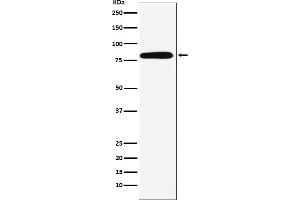 Western blot analysis of Calpain 2 expression in A431 cell lysate. (Recombinant Calpain 2 antibody)