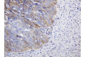 Image no. 2 for anti-CD99 (CD99) antibody (ABIN1497383) (CD99 antibody)
