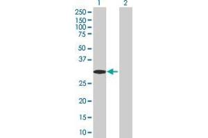 Western Blot analysis of RNF32 expression in transfected 293T cell line ( H00140545-T02 ) by RNF32 MaxPab polyclonal antibody. (RNF32 antibody  (AA 1-256))