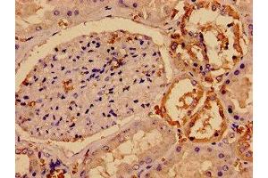 Immunocytochemistry analysis of human kidney tissue using ABIN7170866 at dilution of 1:100 (SMC4 antibody  (AA 406-501))