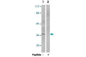 Western blot analysis of extracts from NIH/3T3 cells, using CEBPB polyclonal antibody . (CEBPB antibody)