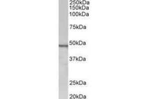 Image no. 1 for anti-Chitotriosidase (CHIT1) (AA 409-423) antibody (ABIN1100790) (Chitotriosidase 1 antibody  (AA 409-423))