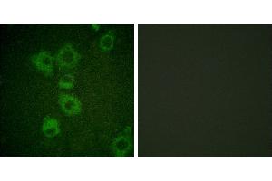 Peptide - +Immunofluorescence analysis of HuvEc cells, using Caspase 6 (Ab-257) antibody. (Caspase 6 antibody)