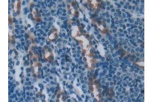Detection of PLS3 in Mouse Kidney Tissue using Polyclonal Antibody to Plastin 3 (PLS3) (Plastin 3 antibody  (AA 5-251))