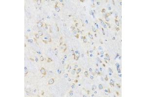 Immunohistochemistry of paraffin-embedded mouse brain using CHIC2 antibody (ABIN6130103, ABIN6138533, ABIN6138534 and ABIN6223980) at dilution of 1:100 (40x lens). (CHIC2 antibody  (AA 1-165))