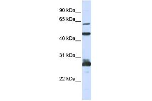 PES1 antibody used at 1 ug/ml to detect target protein. (PES1 antibody)